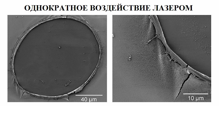 Однократное воздействие лазером